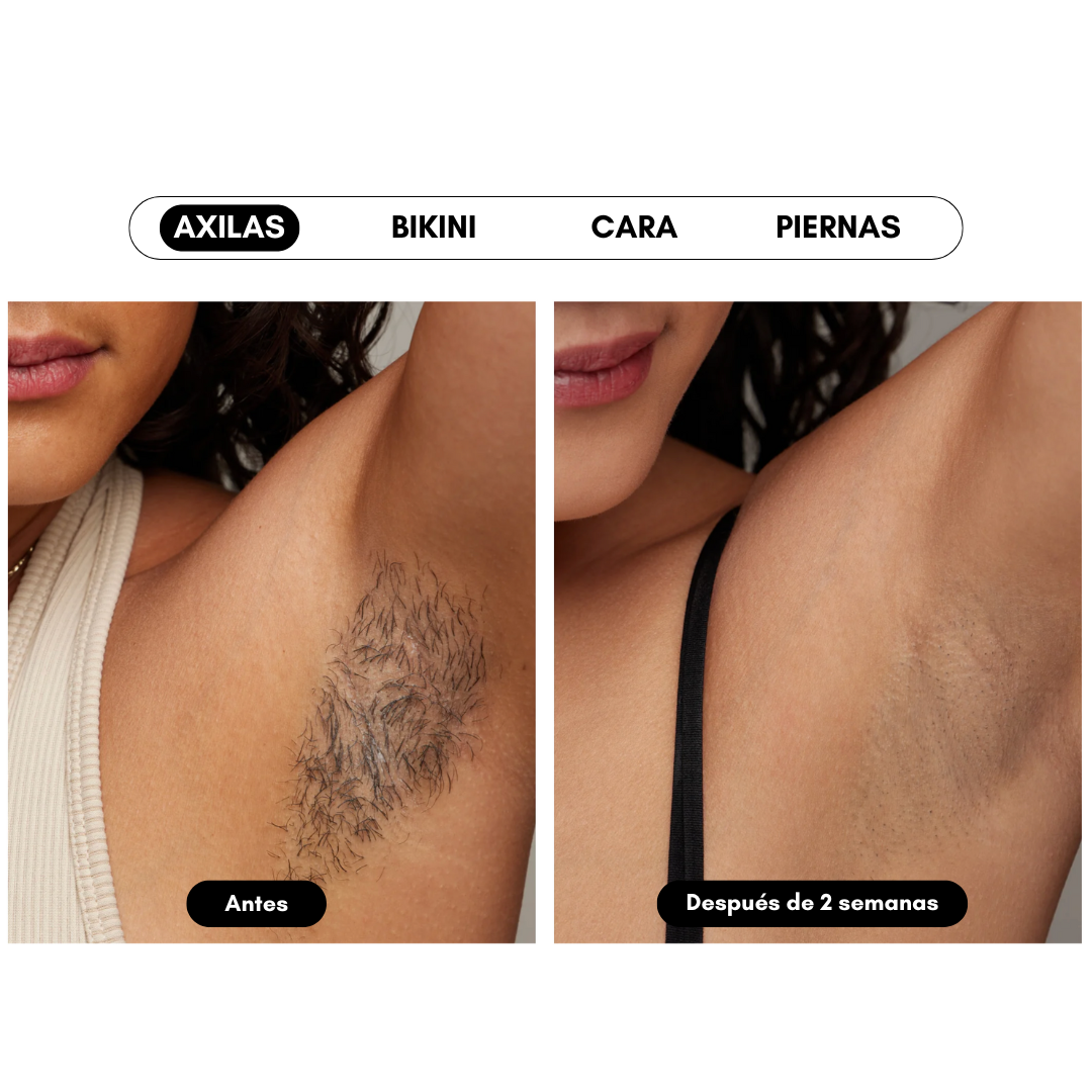 Ulike Air 10 - Aparato de depilación IPL