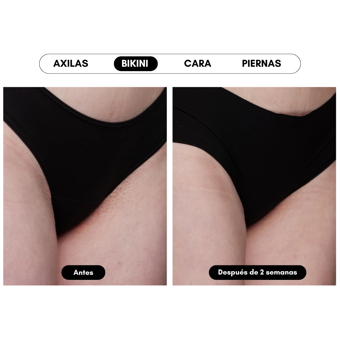 Ulike Air 10 - Aparato de depilación IPL