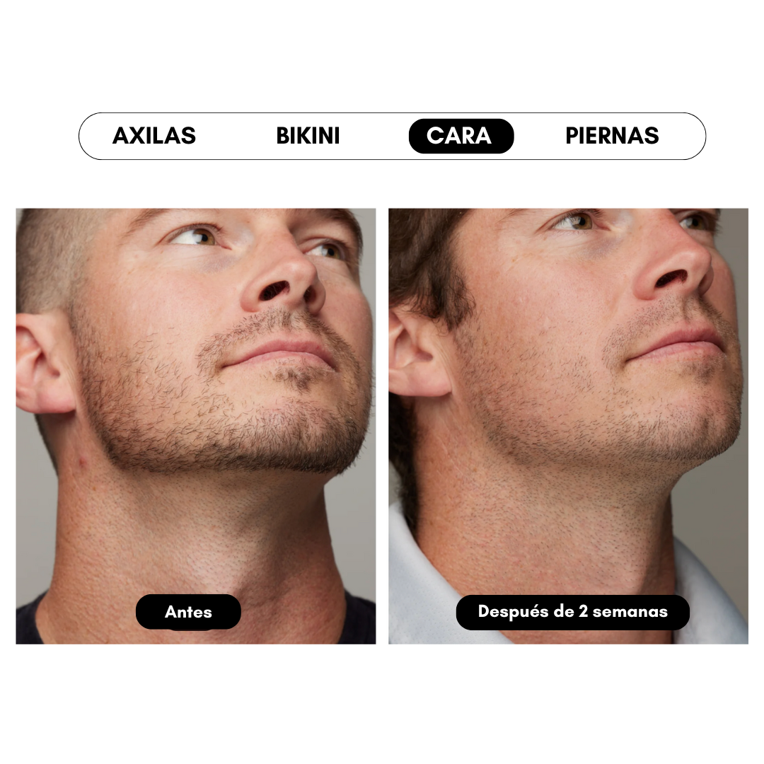 Ulike Air 10 - Aparato de depilación IPL