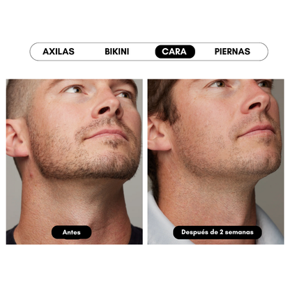 Ulike Air 10 - Aparato de depilación IPL