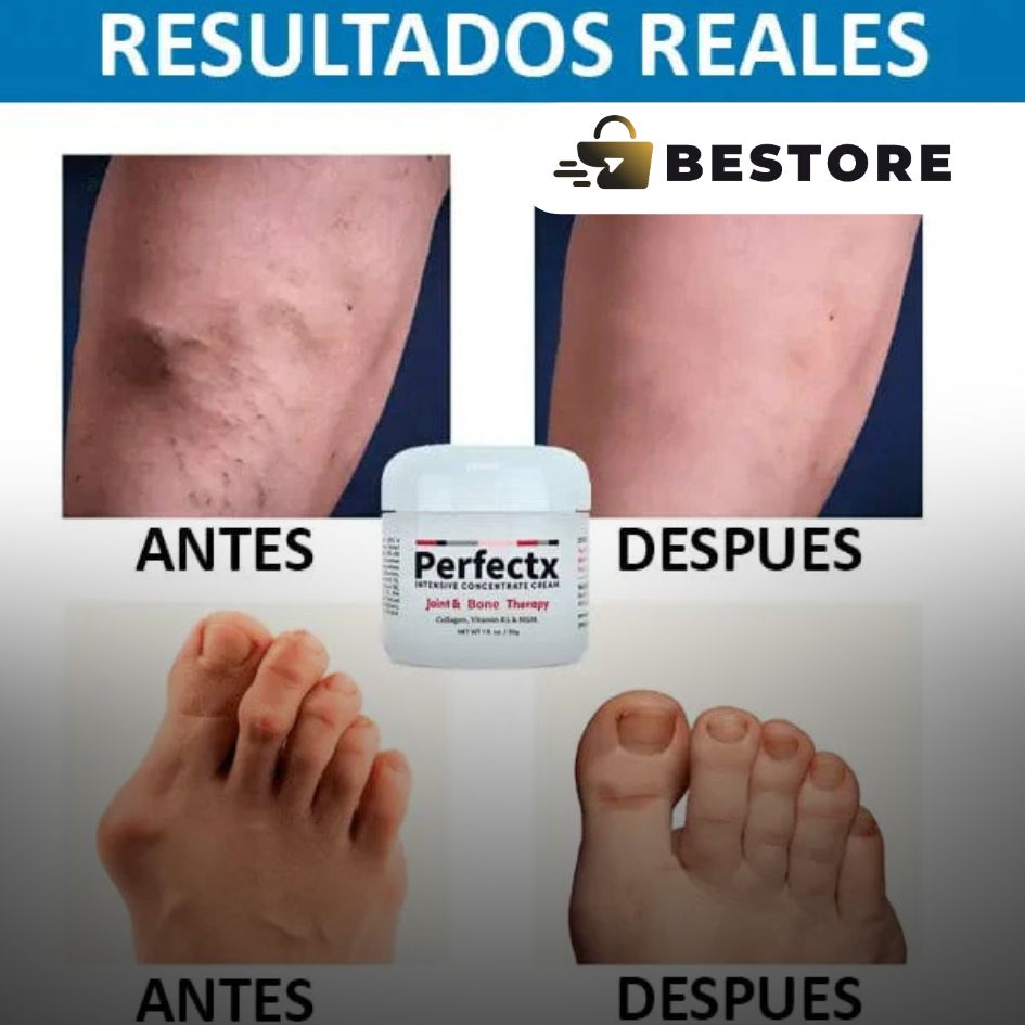 Crema Perfectx Terapia Articular Y Muscular