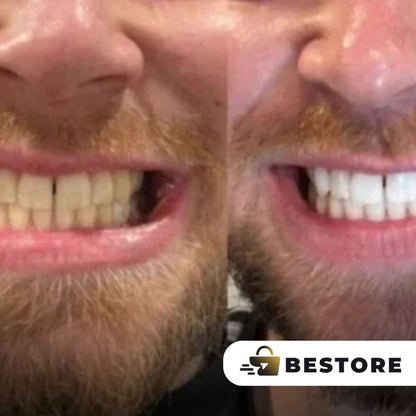 Pasta Blanqueadora Purple Smile