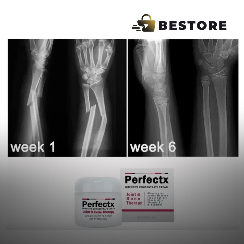 Crema Perfectx Terapia Articular Y Muscular