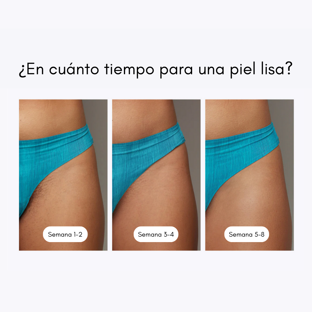 Ulike Air 10 - Aparato de depilación IPL