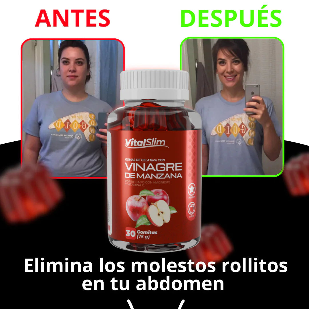 APPLEFIT - Gomitas vinagre manzana 🍏