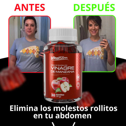 APPLEFIT - Gomitas vinagre manzana 🍏